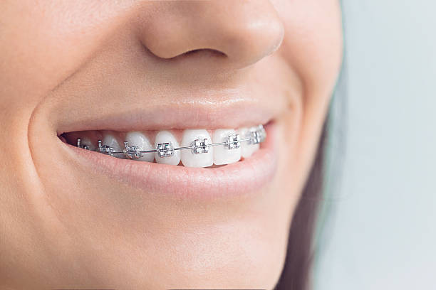 Best Dental Inlays and Onlays  in Acton, CA